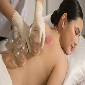 A therapist in Ottawa skillfully handles glass cups as a person lies face down, receiving cupping therapy. The soothing atmosphere echoes the tranquility of a hot stone massage, enhancing the overall relaxation experience.